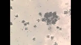 Leishmania major parasites under 400x magnification