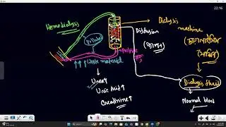 waste and elimination class 3 part 3 (kidney failure,dialysis)