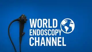 Treatment for a papillary adenoma | Advanced Endoscopy & Health Videos | Colonoscopy, Gastroscopy