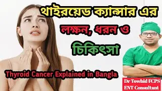 Thyroid Cancer Types, Symptoms & Treatment in Bangla