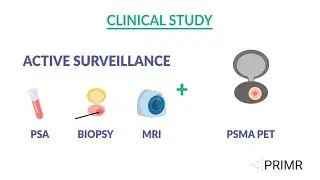 Prostate Cancer Clinical Trial: ESCAPE Trial