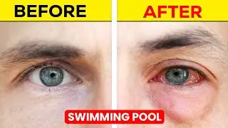 Why Do Eyes Turn Red In Swimming Pool? 😱