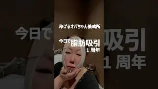 今日で脂肪吸引1周年　 #50代  #60代  #起業   #shorts