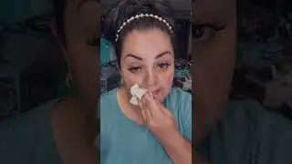 #vitaminc#vitaminac#facetoner#sadoer#koreanskincare#hyperpigmentation#hyperpigmentationtreatment