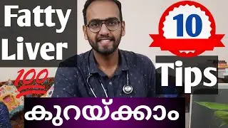 How to reduce fatty liver | മരുന്നില്ലാതെ എങ്ങനെ ഫാറ്റി ലിവർ കുറക്കാം | malayalam | Dr Arundas