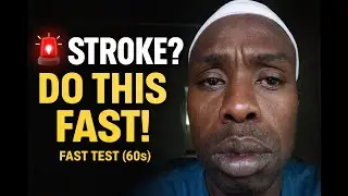 AST Stroke Test Explained in 1 min