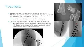 pediatric trauma 2: upper extremity first vidoe