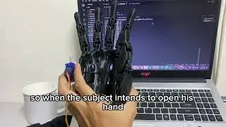 BEC-08 [EEG-Controlled Prosthetic Hand Using OpenBCI for Individuals with Hand Paralysis]
