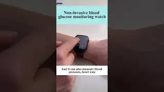 Non-invasive blood glucose test smart watch