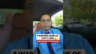 Doctor Sethi Explains 8 Warning Signs of Fatty Liver You Do Not Want To Miss ❌