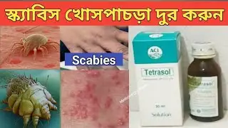 Tetrasol Solution কার্যকারিতা জানুন Monosulfiram BP 25% w/w টেটরাসল সলিউশন টেটরাসল কেন ব্যবহার করব 