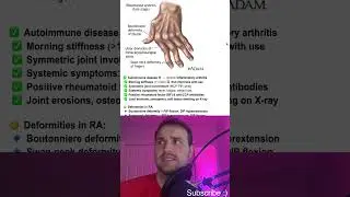 Rheumatoid Arthritis (RA) - Step 1