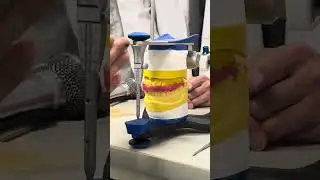 咬合板canine guidance製作
