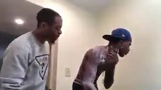 Guy Pulled A Skin Peeling Prank 😳 | Pranl Gone Wrong