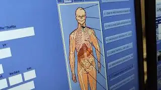How many slices is the CT scanner? GE CT scanner