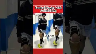 Football With Prosthetic Leg #artificialleg #bornlife #prostheticlimb #foryou #football #shortvideo