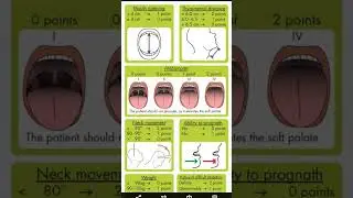 mouth opeing for surgery this malamapathi gradings