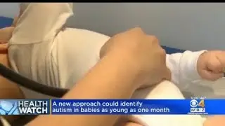 New approach could identify autism in babies as young as one month