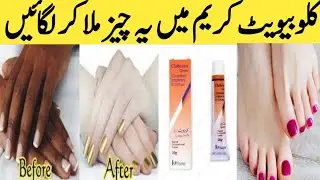Clobevate Cream For Hands & Feet Whitening | Hand and Foot Whitening Formula Cream | Clobevate Cream