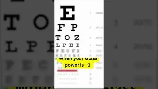 what people see?? with power number -1,-2 and -3 || Arora eye hospital and retina center