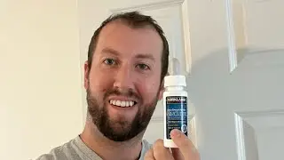 Day 84 - Week 12 Results - FUE Hair Transplant Progress Update - Where To Buy Minoxidil