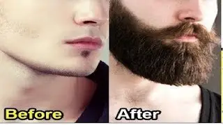 How to grow beard naturally Tips for faster and better growth