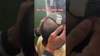 Permanent Hair Wigs In Delhi | 9996900795 | Hair Wigs In Delhi | Hair Patch In Delhi | Rohtak