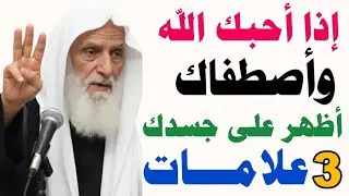 إذا أحبك الله وأصطفاك أظهر على جسدك ثلاث علامات..هنيئاً لمن ظهرت عليه..الشيخ/إبن عثيمين رحمه الله 
