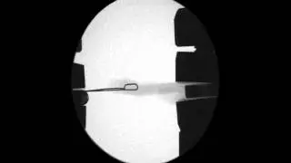 Simple loop lateral