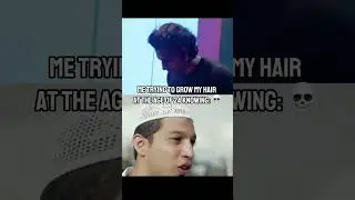 #hairfall #hairfallcauses