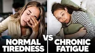 Chronic Fatigue 