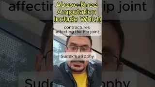 Above Knee Amputation #mrcsstudy  #boardexam2025  #mrcsparta