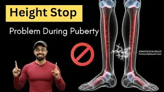 This Problem Stops Height Growth During Puberty In 90% Cases 