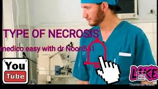 pathology . chapter series of lecture. first chapter . part)2)   type of necrosis  coagulative N.