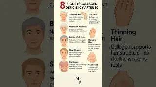 8 Signs of Collagen Deficiency After 50