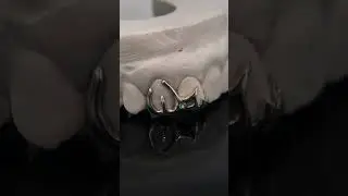 Bespoke Silver Grillz | Custom Jewellery UK