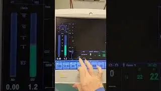 Anesthesia Machine