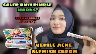 REVIEW JUJUR SALEP BEKAS JERAWAT VERILE || VERILE ACNE BLEMISH CREAM