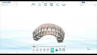 Project Creation with Auto Teeth Segmentation