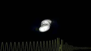 Binary neutron star merger
