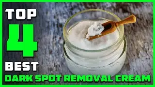 Best Best Dark Spot Removal Cream for Face & Body in 2026 - Top 4 Review