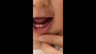 Signs of teething in babies