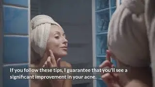 Natural Remedies For Curing Acne