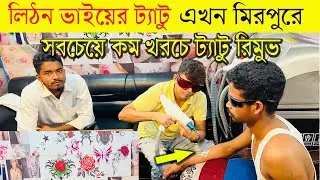 ট্যাটু  বাদশা লিঠন ভাই  😍 BD Tattoo Remove Center Bangladesh 2025 😍 ট্যাটু রিমুভ এখন মিরপুরে 2024