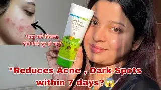 Mamaearth Tea Tree Face Wash Honest Review || Reduces Acne , Pimples & Blemishes within 7 Days?