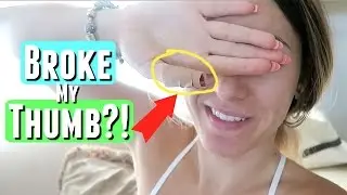 BROKE MY THUMB...?!