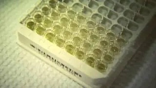Набор Проинсулин - Proinsulin ELISA: как это работает? Mercodia (Швеция)
