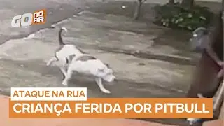 Moradores salvam crian&ccedil;a de ataque de pitbull no meio da rua