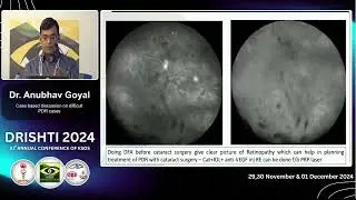 KSOS 2024 IC21 T Dr Anubhav Goyal Case based discussion on difficult PDR cases
