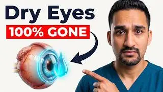 Burning and watery eyes? Dry Eye Treatment at Home | Home Remedies | Symptoms, Cause & Cure